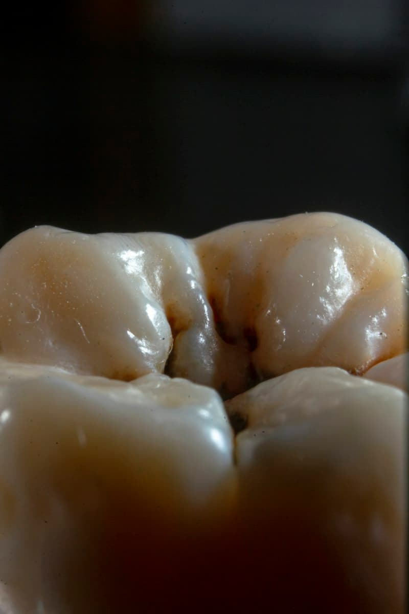 Caries dental