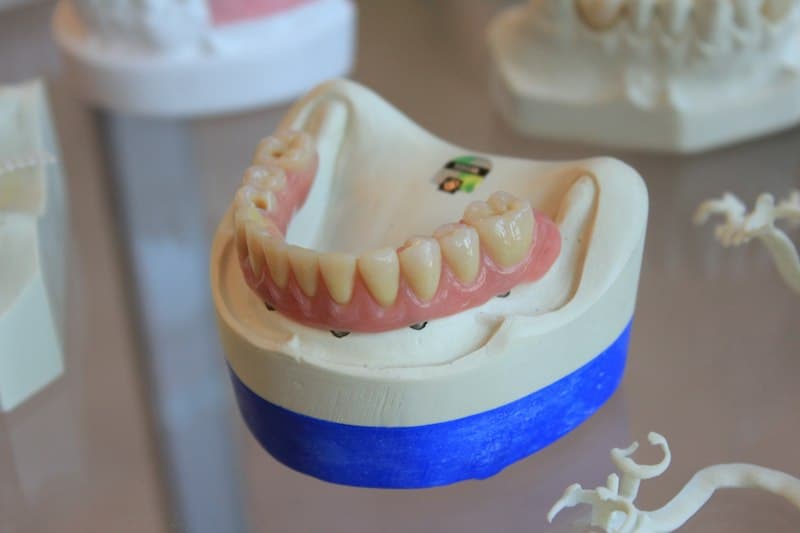 Prótesis dentales